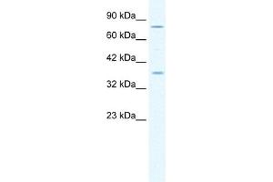 MCM4 antibody used at 1. (MCM4 anticorps  (Middle Region))