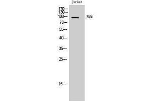 Western Blotting (WB) image for anti-Egf-Like Module Containing, Mucin-Like, Hormone Receptor-Like 1 (EMR1) (C-Term) antibody (ABIN3184473)