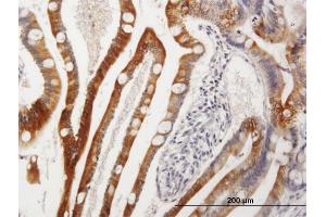 Immunoperoxidase of purified MaxPab antibody to CYP3A4 on formalin-fixed paraffin-embedded human small Intestine.