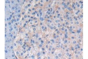 Detection of ATF6 in Human Pancreas Tissue using Polyclonal Antibody to Activating Transcription Factor 6 (ATF6)