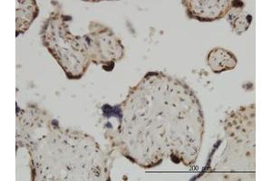Image no. 1 for anti-Zic Family Member 4 (ZIC4) (AA 249-320) antibody (ABIN466251) (ZIC4 anticorps  (AA 249-320))