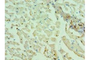 Immunohistochemistry of paraffin-embedded human heart tissue using ABIN7160559 at dilution of 1:100