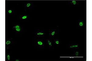 Immunofluorescence of monoclonal antibody to HES2 on HeLa cell. (HES2 anticorps  (AA 41-114))
