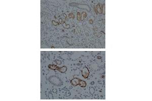 Sample Type:  Human Kidney   Dilution:  1:100 (CYP1A1 anticorps  (Middle Region))