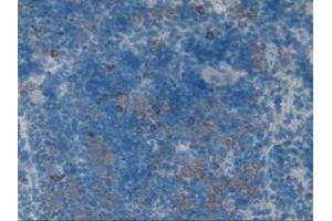 Detection of CSPG5 in Rat Spleen Tissue using Polyclonal Antibody to Chondroitin Sulfate Proteoglycan 5 (CSPG5)