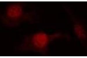 Immunofluorescent analysis of PTEN (pS380/T382/T383) staining in Hela cells. (PTEN anticorps  (C-Term, pSer380, pThr382, pThr383))