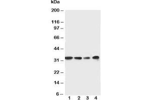 Western blot testing of MyD88 antibody and Lane 1:  rat spleen;  2: rat thymus;  3: Jurkat;  4: Raji cell lysate. (MYD88 anticorps  (Middle Region))