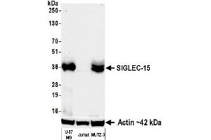 Western Blotting (WB) image for anti-Sialic Acid Binding Ig-Like Lectin 15 (SIGLEC15) (C-Term) antibody (ABIN7795674)