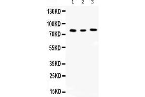 Western blot analysis of Cyclin T1 expression in rat kidney extract ( Lane 1), mouse spleen extract ( Lane 2) and JURKAT whole cell lysates ( Lane 3). (Cyclin T1 anticorps  (Middle Region))