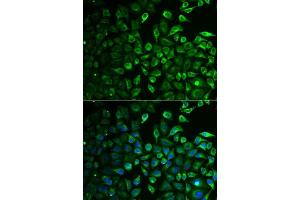 Immunofluorescence analysis of A549 cells using IMPA1 antibody. (IMPA1 anticorps  (AA 1-277))