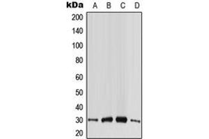Western blot analysis of CABP4 expression in HeLa (A), HepG2 (B), SP2/0 (C), PC12 (D) whole cell lysates. (CABP4 anticorps  (Center))