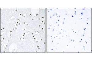 Immunohistochemistry analysis of paraffin-embedded human brain tissue, using c-Jun (Ab-243) Antibody. (C-JUN anticorps  (AA 210-259))