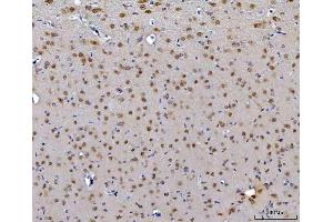 IHC analysis of CEP250 using anti-CEP250 antibody (ABIN7602053). (CEP250 anticorps  (AA 563-853))