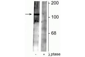 Western blot of rat synaptic membrane lysate showing specific immunolabeling of the ~102 kDa GABAB R2 protein phosphorylated at Ser783 in the first lane (-). (GABBR2 anticorps  (pSer783))