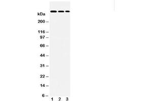 Western blot testing of LAMA2 antibody and Lane 1:  HeLa;  2: A549;  3: PANC lysate