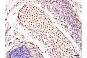 Formalin-fixed and paraffin embedded mouse tooth germ labeled with Anti-Oct-3/Oct-4 Polyclonal Antibody, Unconjugated  at 1:200 followed by conjugation to the secondary antibody and DAB staining. (OCT4 anticorps  (AA 201-300))