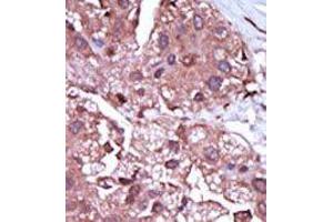 Image no. 2 for anti-Activin A Receptor Type II-Like 1 (ACVRL1) (C-Term) antibody (ABIN360125) (ACVRL1 anticorps  (C-Term))
