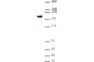 ZEB1 antibody (pAb) tested by Western blot. (ZEB1 anticorps  (N-Term))