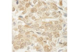 Immunohistochemistry (IHC) image for anti-Mediator Complex Subunit 15 (MED15) (AA 450-500) antibody (ABIN7448662)