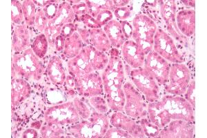 Human Kidney: Formalin-Fixed, Paraffin-Embedded (FFPE)