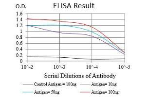Black line: Control Antigen (100 ng), Purple line: Antigen(10 ng), Blue line: Antigen (50 ng), Red line: Antigen (100 ng),