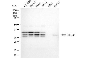 Western blotting analysis using EIF4E2 antibody (ABIN7798533).