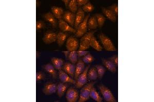Immunofluorescence analysis of HeLa cells using B3GNT4 antibody (ABIN7265875) at dilution of 1:100.