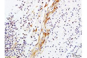 Formalin-fixed and paraffin-embedded rat skin tissue labeled with Anti-Collagen V Polyclonal Antibody, Unconjugated  1:200 followed by conjugation to the secondary antibody and DAB staining
