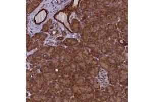 Immunohistochemical staining of human pancreas with ANKRD39 polyclonal antibody  shows strong cytoplasmic positivity in exocrine glandular cells at 1:10-1:20 dilution. (ANKRD39 anticorps)