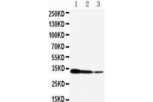 Western Blotting (WB) image for anti-CREB Regulated Transcription Coactivator 2 (CRTC2) (AA 595-611), (C-Term) antibody (ABIN3042964) (CRTC2 anticorps  (C-Term))