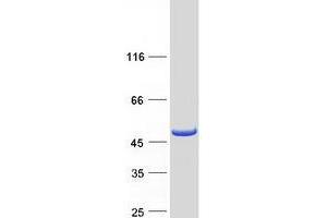 Validation with Western Blot