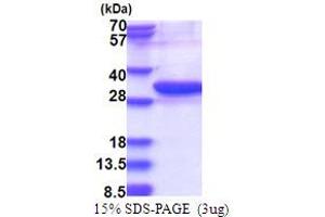 SDS-PAGE (SDS) image for Ubiquitin-Conjugating Enzyme E2Z (UBE2Z) (AA 1-246) protein (His tag) (ABIN5853763) (UBE2Z Protein (AA 1-246) (His tag))