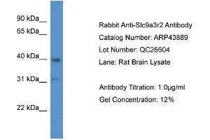 Western Blotting (WB) image for anti-Solute Carrier Family 9 (Sodium/hydrogen Exchanger), Member 3 Regulator 2 (SLC9A3R2) (N-Term) antibody (ABIN2781612) (SLC9A3R2 anticorps  (N-Term))