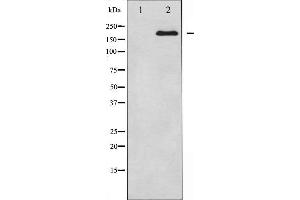 Western blot analysis of BRCA1 expression in whole cell lysates,The lane on the left is treated with the antigen-specific peptide. (BRCA1 anticorps  (Internal Region))