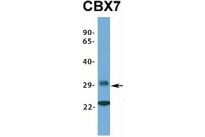 Host:  Rabbit  Target Name:  CBX7  Sample Type:  721_B  Antibody Dilution:  1. (CBX7 anticorps  (Middle Region))