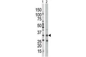 AMPK beta 1 antibody used in western blot to detect PRKAB1 in Jurkat cell lysate (Lane 1) and mouse spleen tissue lysate (2).