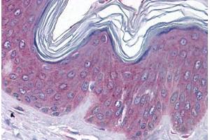 anti-Gap Junction Protein, beta 1, 32kDa (GJB1) (C-Term) antibody