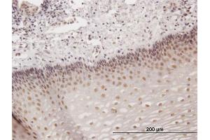 Immunoperoxidase of purified MaxPab antibody to KIAA1443 on formalin-fixed paraffin-embedded human esophagus. (HOMEZ anticorps  (AA 1-526))