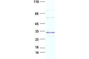 Validation with Western Blot