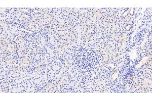 Detection of PDGFC in Human Kidney Tissue using Polyclonal Antibody to Platelet Derived Growth Factor C (PDGFC) (PDGFC anticorps  (AA 235-345))