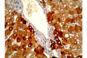Immunohistochemistry staining using CYP2A6 monoclonal antibody, clone F16 P2 D8  on normal human liver tissue at 1 ug/mL . (CYP2A6 anticorps  (C-Term))