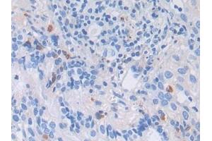 anti-Low Density Lipoprotein Receptor-Related Protein 1 (LRP1) (AA 4441-4544) antibody