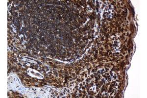 Image no. 5 for anti-SERPINE1 mRNA Binding Protein 1 (SERBP1) (AA 1-262) antibody (ABIN1490675)