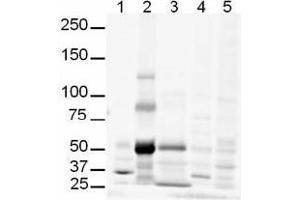 Image no. 1 for anti-GLI Family Zinc Finger 3 (GLI3) (AA 41-57) antibody (ABIN401281) (GLI3 anticorps  (AA 41-57))