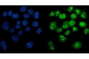 IF analysis of PARP using anti-PARP antibody (ABIN7602277). (PARP1 anticorps  (AA 670-858))