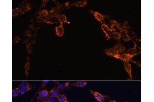 Immunofluorescence analysis of HeLa cells using POR Polyclonal Antibody at dilution of 1:100 (40x lens). (POR anticorps)