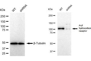 Western blotting analysis using Aryl hydrocarbon receptor antibody (ABIN7797656). (Recombinant Aryl Hydrocarbon Receptor anticorps)