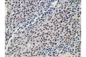 Image no. 3 for anti-Deoxycytidine Kinase (DCK) antibody (ABIN1497775)