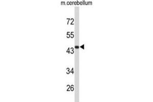Western Blotting (WB) image for anti-Fibromodulin (FMOD) antibody (ABIN3004097) (Fibromodulin anticorps)