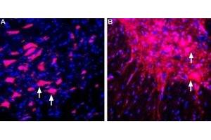 Expression of LINGO-1 in rat brain and spinal cord - Immunohistochemical staining of perfusion-fixed frozen rat brain sections using Anti-LINGO-1 (extracellular) Antibody (ABIN7043298, ABIN7044790 and ABIN7044791), (1:400), followed by donkey-anti-rabbit-Cy3. (LINGO1 anticorps  (Extracellular, N-Term))